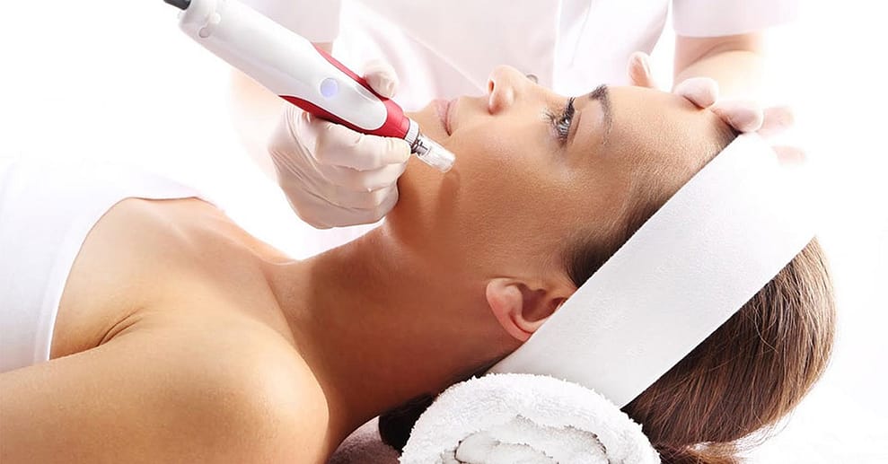 Microneedling mit Hyaluron Leipzig/Halle OXGE.com Special Offers, Deals & Discounts in Germany