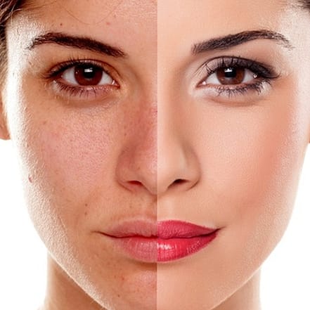 Bis zu 75% Rabatt auf den Kosmetische Gesichtsbehandlung bei Beauty Rebel Berlin OXGE.com Special Offers, Deals & Discounts in Germany