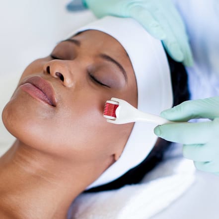 Schöne, frische Haut mit einer 45 Min. Microneedling-Behandlung Frankfurt OXGE.com Special Offers, Deals & Discounts in Germany