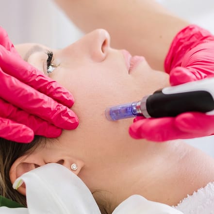 60 Minuten Microneedling München OXGE.com Special Offers, Deals & Discounts in Germany
