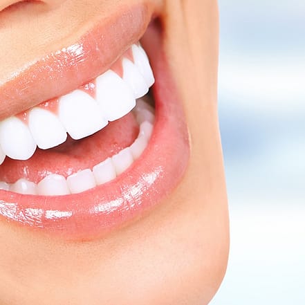 Kosmetisches Zahn-Bleaching Dortmund OXGE.com Special Offers, Deals & Discounts in Germany