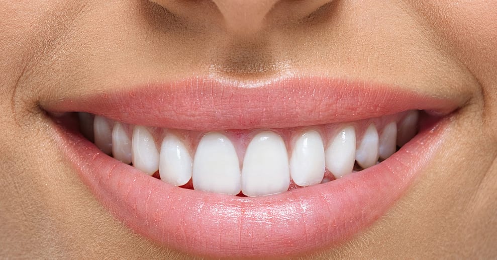 Kosmetisches Zahn-Bleaching Frankfurt OXGE.com Special Offers, Deals & Discounts in Germany