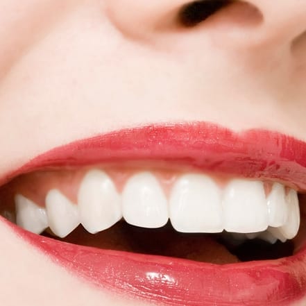 Wertgutschein über 79 € anrechenbar auf kosmetisches Zahn-Bleaching Köln OXGE.com Special Offers, Deals & Discounts in Germany