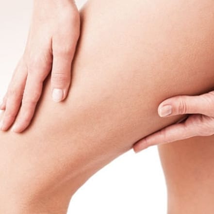 Cellulite-Behandlung Mainz OXGE.com Special Offers, Deals & Discounts in Germany