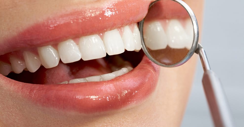 Hallo, strahlendes Lächeln: Kosmetisches Zahnbleaching – 1-2 Personen Köln OXGE.com Special Offers, Deals & Discounts in Germany