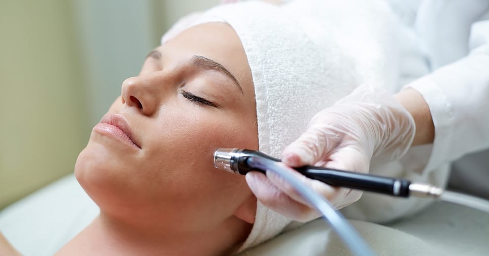 Micro-Needling Stuttgart OXGE.com Special Offers, Deals & Discounts in Germany