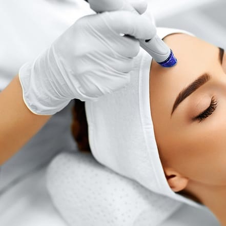 Microneedling inkl. Hyaluron Bielefeld OXGE.com Special Offers, Deals & Discounts in Germany