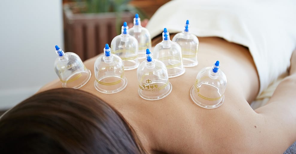 58% Rabatt auf Schröpfmassage bei Heilpraktiker Oliver Parr Hamburg OXGE.com Special Offers, Deals & Discounts in Germany