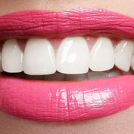 Zahn-Bleaching Classic (45 Min.) oder Premium (60 Min.) für 1 Person Würzburg OXGE.com Special Offers, Deals & Discounts in Germany