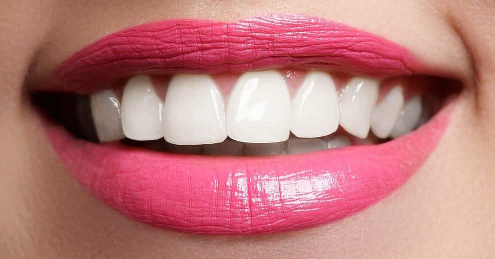 Zahn-Bleaching Classic (45 Min.) oder Premium (60 Min.) für 1 Person Würzburg OXGE.com Special Offers, Deals & Discounts in Germany
