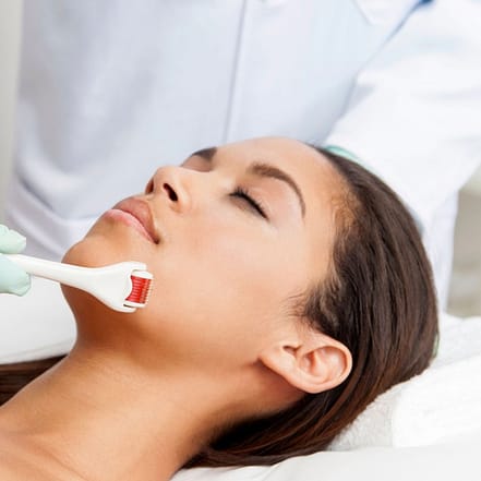Aqua-Facial + Microneedling, 3x Aqua-Facial oder 3x Microneedling Hamburg OXGE.com Special Offers, Deals & Discounts in Germany
