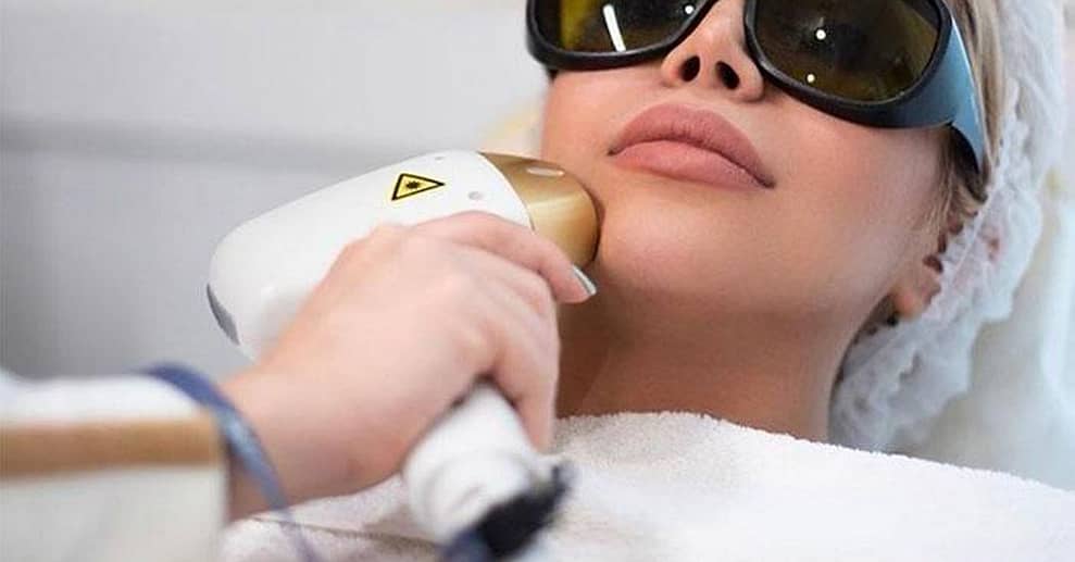 3 – 6 Behandlungen für eine Haarentfernung mit Diodenlaser Hannover OXGE.com Special Offers, Deals & Discounts in Germany