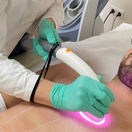 Laser-Haarentfernung Berlin OXGE.com Special Offers, Deals & Discounts in Germany