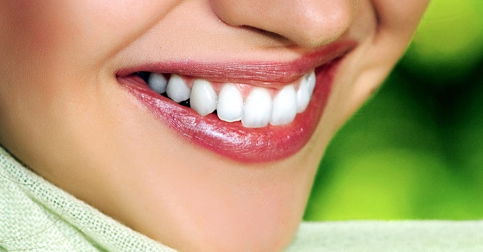 Kosmetisches Zahn-Bleaching Wiesbaden OXGE.com Special Offers, Deals & Discounts in Germany