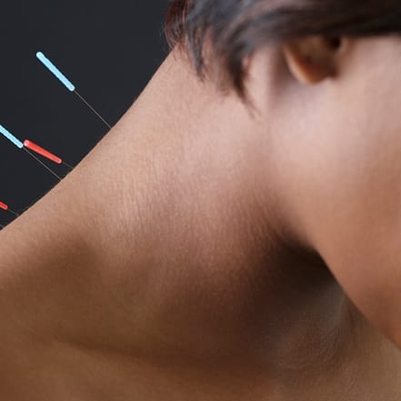 Bis zu 67% Rabatt auf den bei Aesthetic Care Hannover Hannover OXGE.com Special Offers, Deals & Discounts in Germany 3