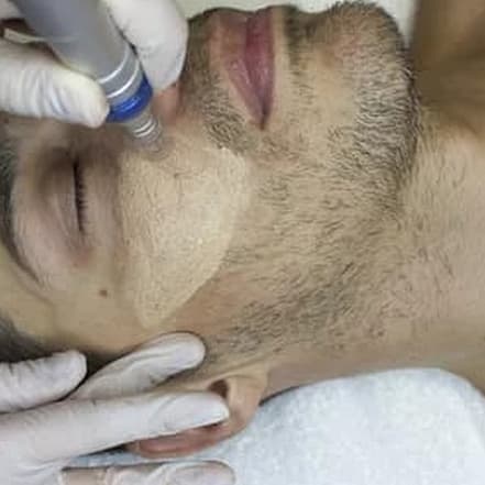1 oder 2 BB-Glow- oder Microneedling-Behandlungen für 1 Person Hamburg OXGE.com Special Offers, Deals & Discounts in Germany