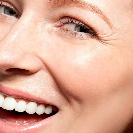 1x oder 2x 40 Min. Kosmetisches Zahn-Bleaching für 1 Person Düsseldorf OXGE.com Special Offers, Deals & Discounts in Germany