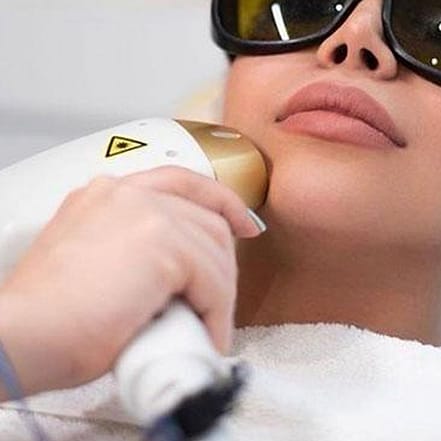 3 – 6 Behandlungen für eine Haarentfernung mit Diodenlaser Hannover OXGE.com Special Offers, Deals & Discounts in Germany