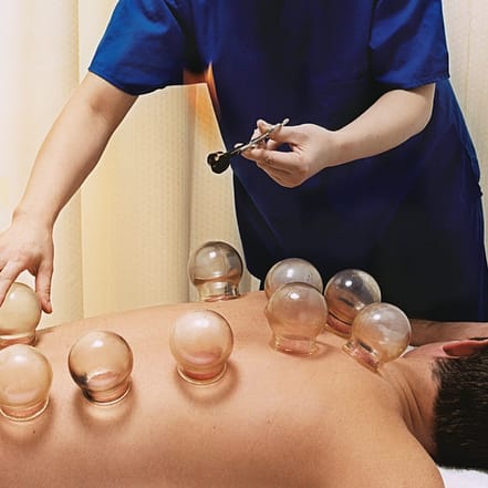 60 Min. Schröpftherapie Berlin OXGE.com Special Offers, Deals & Discounts in Germany