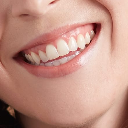 60 Min. kosmetisches Zahn-Bleaching Essen OXGE.com Special Offers, Deals & Discounts in Germany