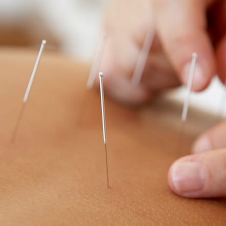 Akupunktur zum Thema nach Wahl Bielefeld OXGE.com Special Offers, Deals & Discounts in Germany