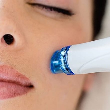 Aqua Facial-Gesichtstiefenreinigung Karlsruhe OXGE.com Special Offers, Deals & Discounts in Germany