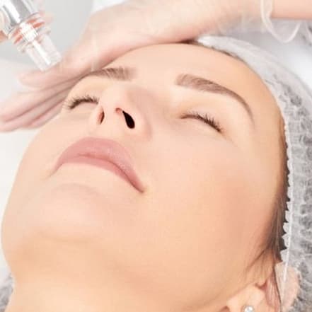 Aqua-Facial inkl. JetPeeling für 1 Person: Für ein frisches Hautbild Berlin OXGE.com Special Offers, Deals & Discounts in Germany