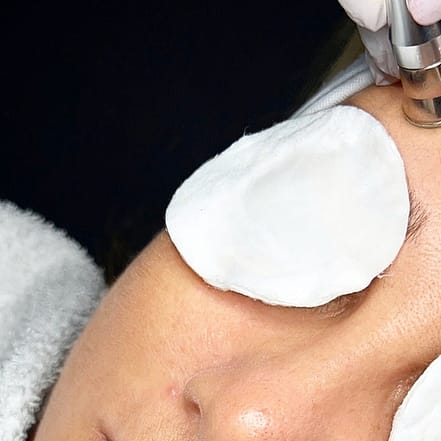 BB-Glow-Behandlung inkl. Microneedling opt. mit Wimpern-/Brauenlifting München OXGE.com Special Offers, Deals & Discounts in Germany