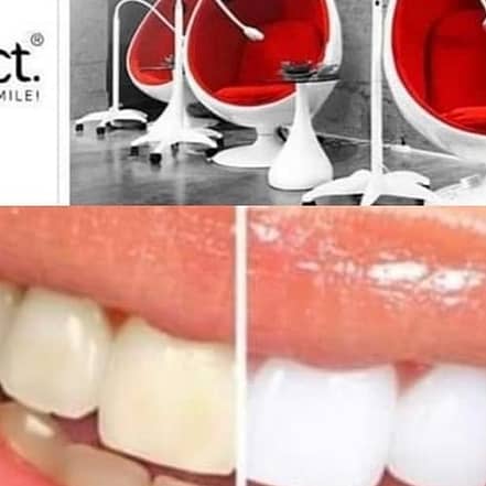 Bis zu 50% Rabatt auf den Bleaching – Beim Zahnarzt – Nicht markengeschützt bei Elegant Beauty Laser München OXGE.com Special Offers, Deals & Discounts in Germany