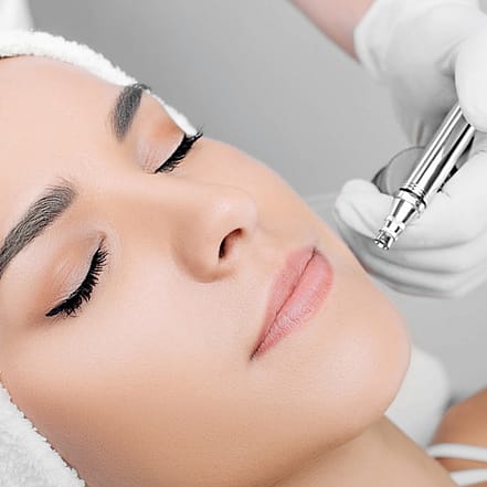 Strahlende Haut: Diamant-Mikrodermabrasion oder Microneedling Berlin OXGE.com Special Offers, Deals & Discounts in Germany