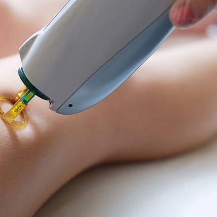 Drei Wellen ICE Diodenlaser-Haarentfernung an einer großen Zone Berlin OXGE.com Special Offers, Deals & Discounts in Germany