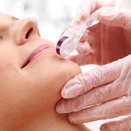 Microneedling mit Anti-Age Gesichtsbehandlung oder BB Glow Serum Hamburg OXGE.com Special Offers, Deals & Discounts in Germany