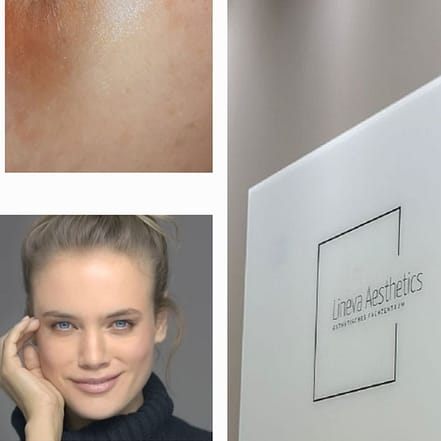 Gesichtsbehandlung – Anti-Aging Frankfurt OXGE.com Special Offers, Deals & Discounts in Germany