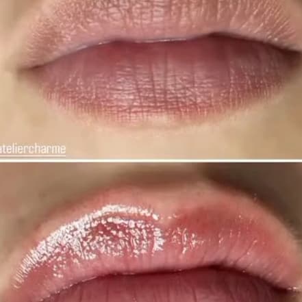 Gesichtsbehandlung – Anti-Aging Mannheim OXGE.com Special Offers, Deals & Discounts in Germany