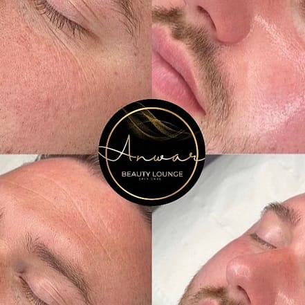 Gesichtsbehandlung – HydraFacial Köln OXGE.com Special Offers, Deals & Discounts in Germany