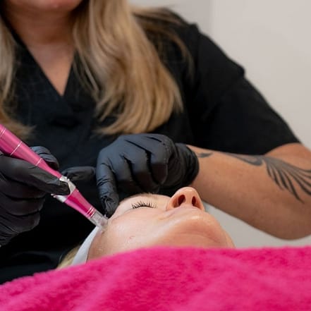 Gesichtsbehandlung/Microneedling Frankfurt OXGE.com Special Offers, Deals & Discounts in Germany