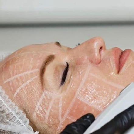 HIFU-Ultraschall-Behandlung München OXGE.com Special Offers, Deals & Discounts in Germany
