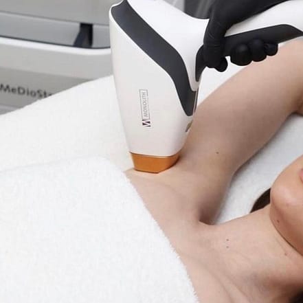 Haarentfernung mit Diodenlaser an 1 Zone nach Wahl für 1 Person Frankfurt OXGE.com Special Offers, Deals & Discounts in Germany