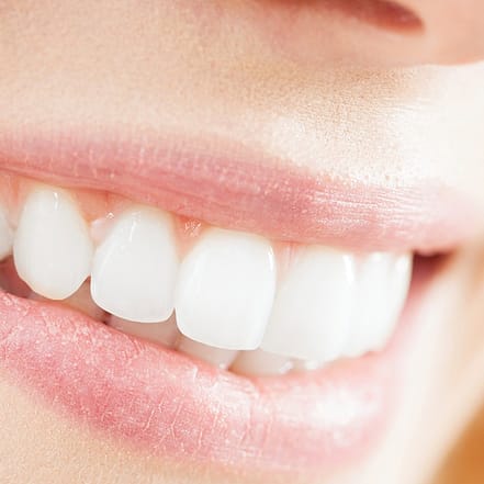 Diodenlaser-Haarentfernung Frankfurt OXGE.com Special Offers, Deals & Discounts in Germany 3