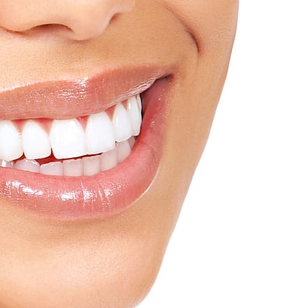 Kosmetisches Zahn-Bleaching Essen OXGE.com Special Offers, Deals & Discounts in Germany