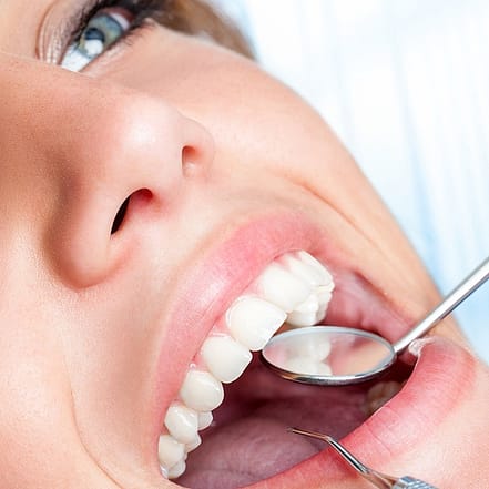 Kosmetisches Zahn-Bleaching Mannheim OXGE.com Special Offers, Deals & Discounts in Germany
