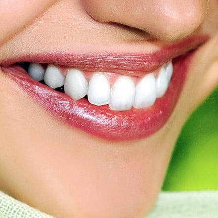 Kosmetisches Zahn-Bleaching Wiesbaden OXGE.com Special Offers, Deals & Discounts in Germany