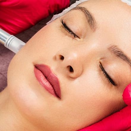 Micro-Needling Berlin OXGE.com Special Offers, Deals & Discounts in Germany