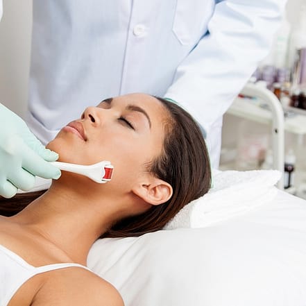 Microneedling inkl. Hyaluron Wiesbaden OXGE.com Special Offers, Deals & Discounts in Germany