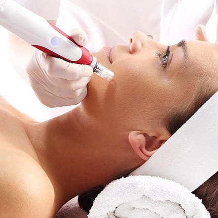 Microneedling mit Hyaluron Leipzig/Halle OXGE.com Special Offers, Deals & Discounts in Germany