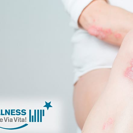 Online-Kurs „Schuppenflechte (Psoriasis)“ National Deal OXGE.com Special Offers, Deals & Discounts in Germany
