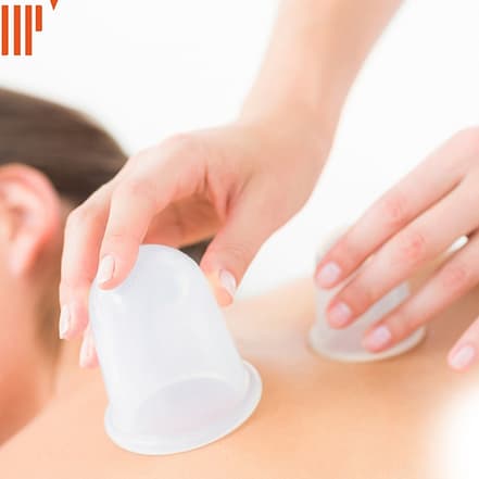 Schröpf-Massage – Onlinekurs National Deal OXGE.com Special Offers, Deals & Discounts in Germany