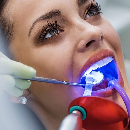 Weißere Zähne in nur wenigen Minuten: Kosmetisches Zahn-Bleaching Frankfurt OXGE.com Special Offers, Deals & Discounts in Germany