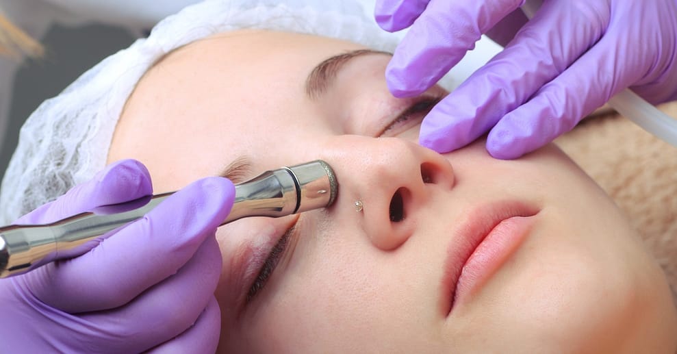 1x / 3x / 5x 30 Min. Diamant-Mikrodermabrasion für 1 Person Berlin OXGE.com Special Offers, Deals & Discounts in Germany