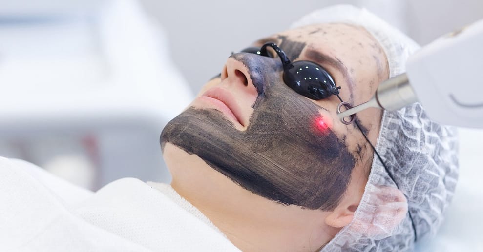 1x/2x/3x 50 Min. Carbon-Laser-Peeling mit Hyaluron-Ampulle für 1 Pers. Mannheim OXGE.com Special Offers, Deals & Discounts in Germany